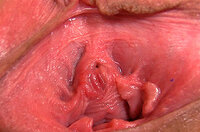 Register Pussy My Gape s1
